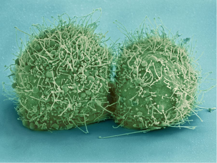 Colourised electron micrograph of two round, green-tinted cells side by side, their surfaces covered in fine hair-like projections.