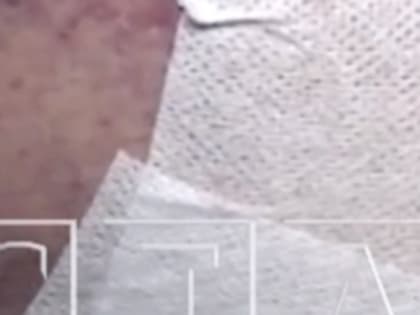 Нижегородку госпитализировали после нападения тибетского мастифа в Новинках