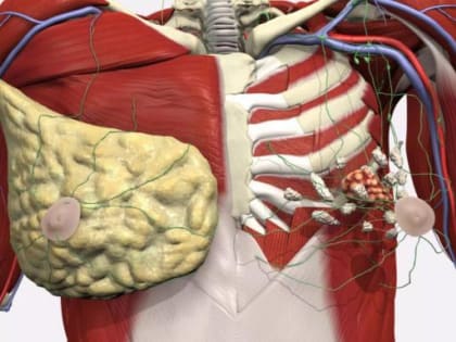 Рак молочной железы: об этом нужно знать