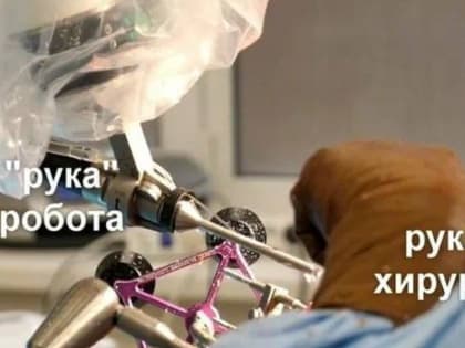 Нижний Новгород внедряет роботизированную хирургию для коленных суставов