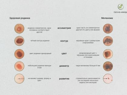 Вопрос-ответ. Как отличить здоровую родинку от меланомы?