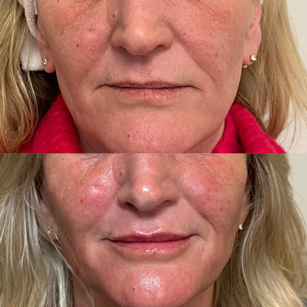 Aesthetic Before And After