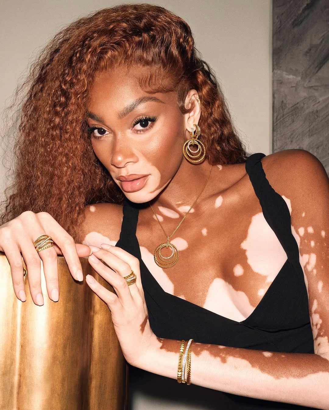 Winnie Harlow