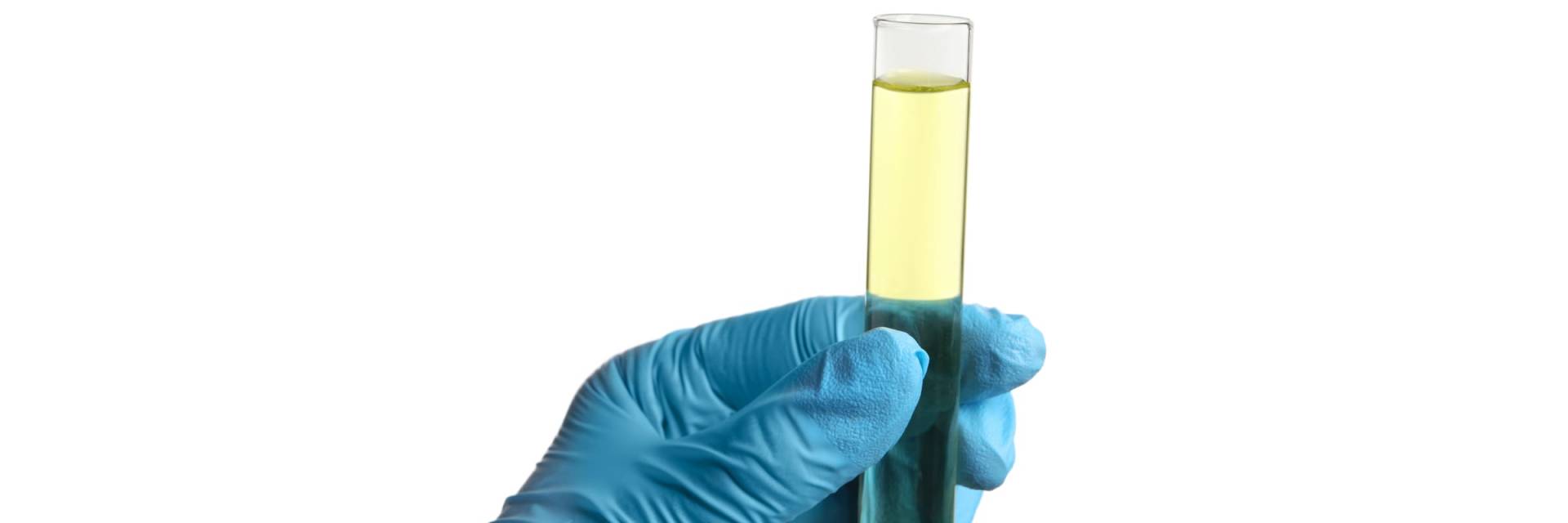 Que se passe-t-il avec les excréments et l’urine dans la fosse septique ?