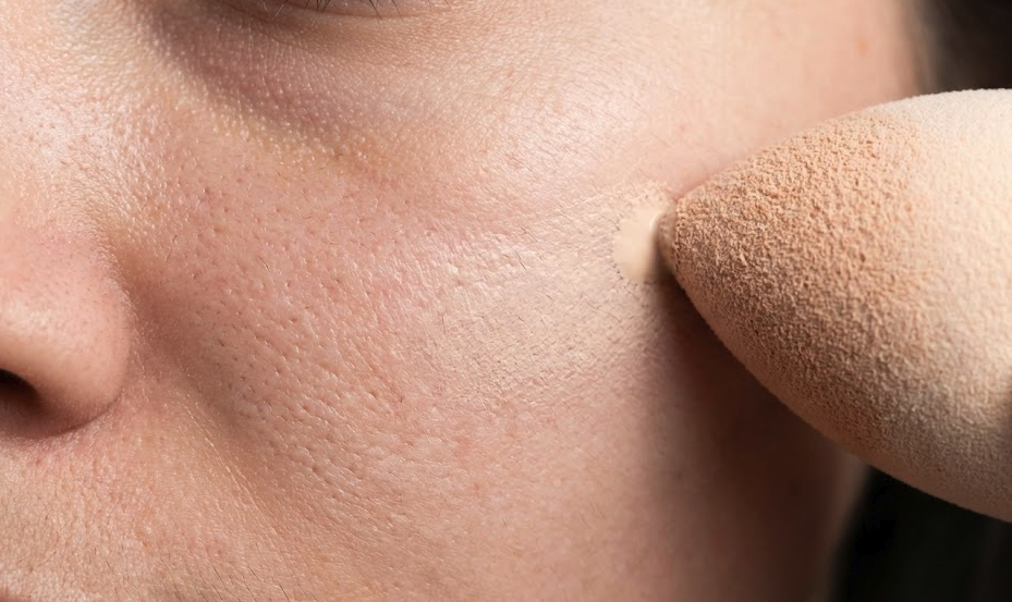 Cara Menutupi Bekas Jerawat