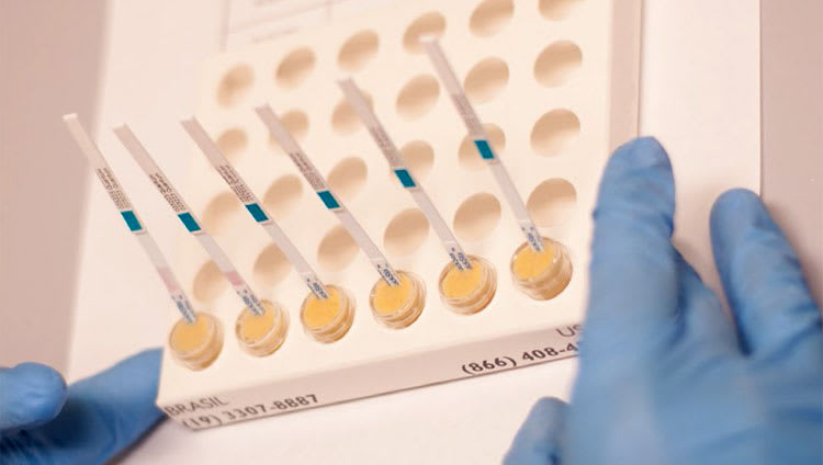 Trial confirms the need to analyse in feed enzyme activity