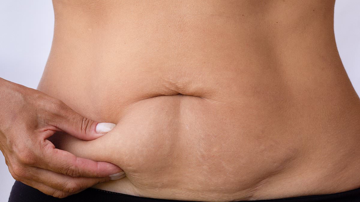 Non-surgical Treatments for Saggy Skin: Expert Insights on Effective and Ineffective Options