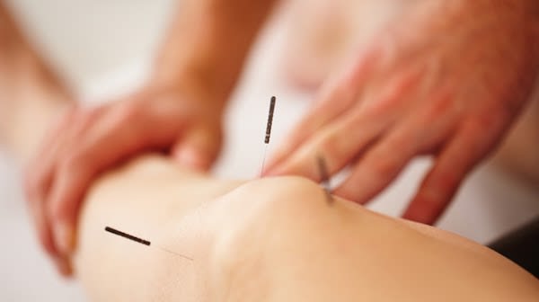Acupuncture Chang - Xiong Chang