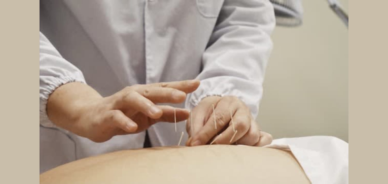 Li Acupuncture and Herbs - Janny Li — image 1
