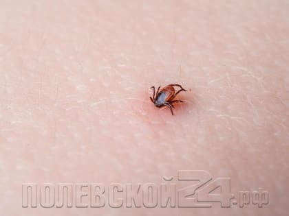 С весной пришли клещи и начали кусать полевчан