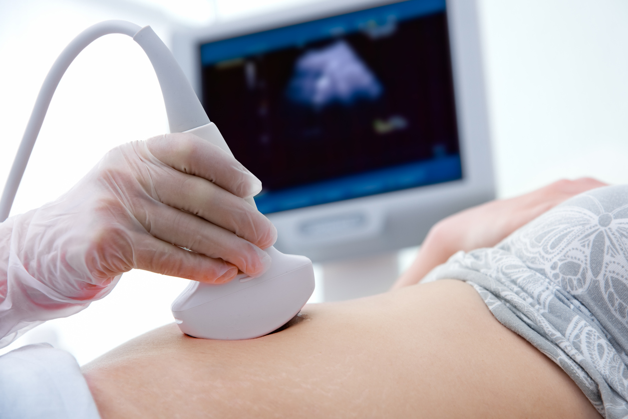 woman getting an ultrasound