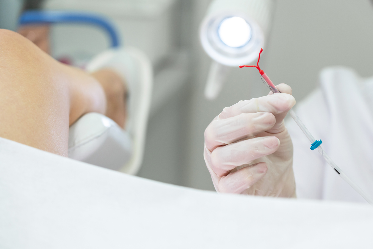 woman in stirrups about to have an iud insertion