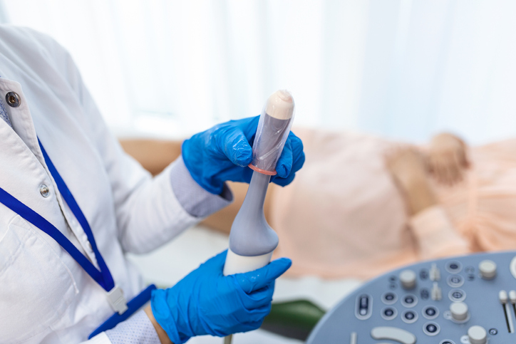 technician putting a condom on a transvaginal ultrasound probe