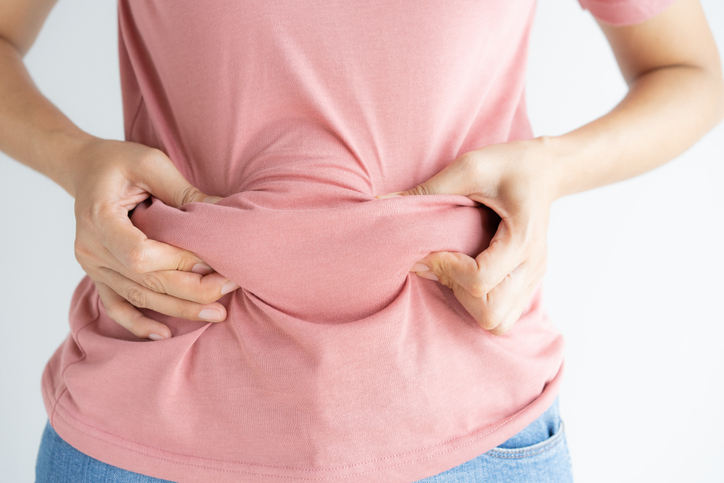 woman grabbing the rolls of her pcos belly