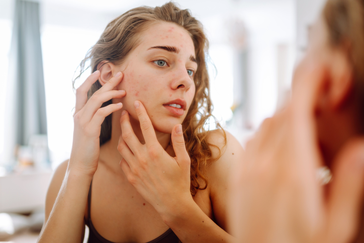 woman popping pimples in the mirror