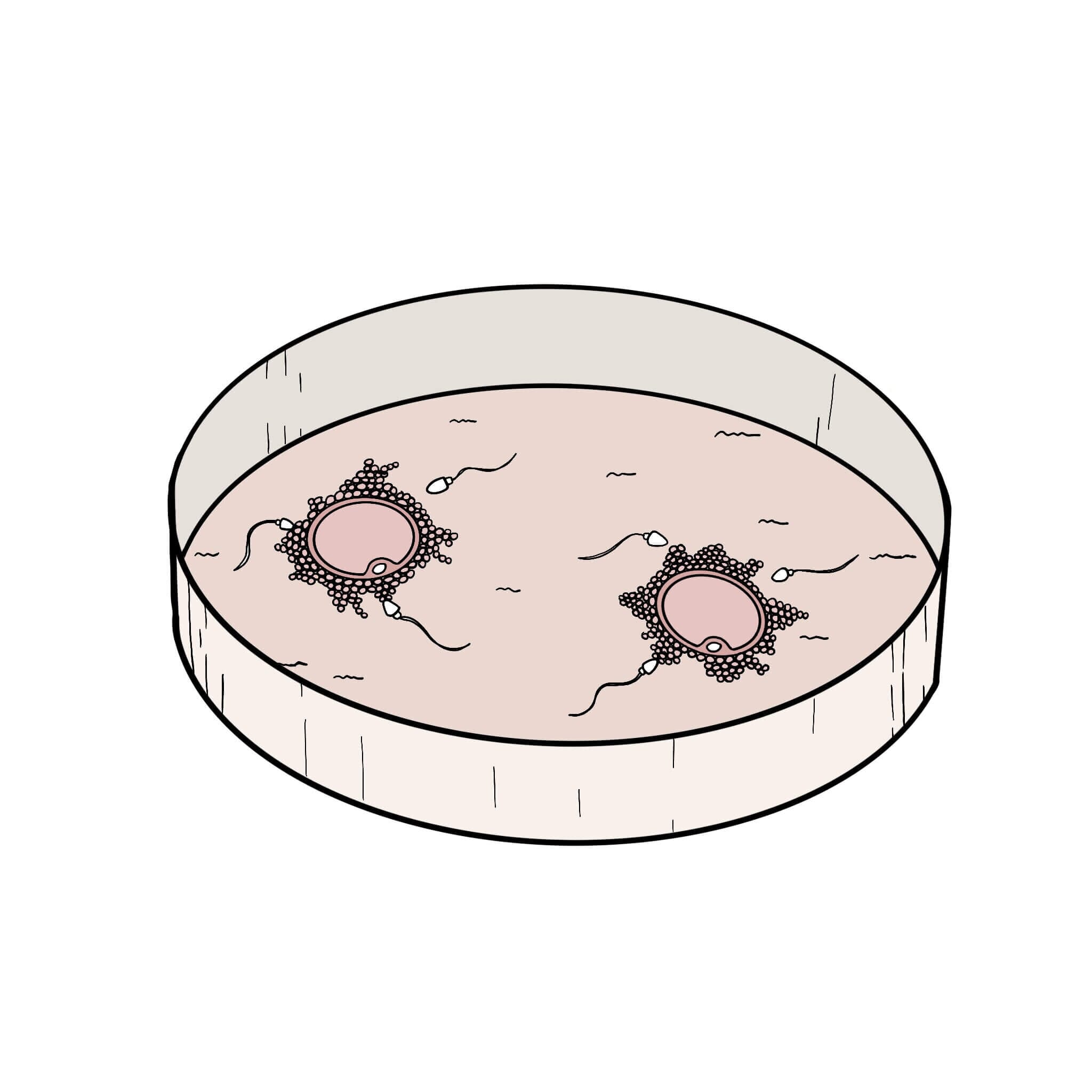 ivf insemination graphic