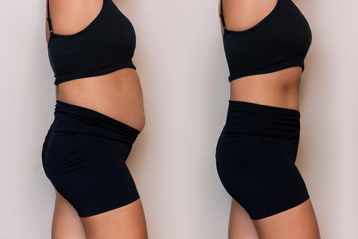 side by side images of a woman sucking in her belly vs not sucking it in