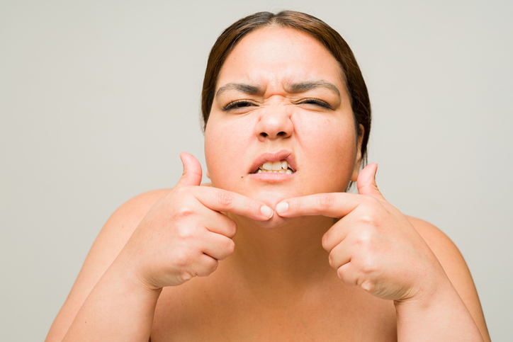 woman popping a zit