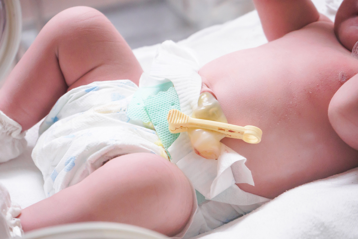 newborn baby in diaper with their imbelical cord clamped and cut