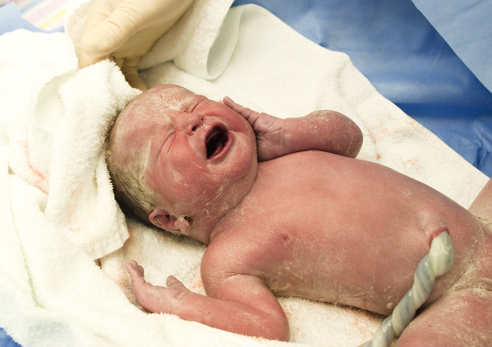 newborn baby covered in vernix caseosa
