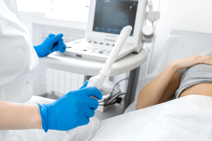 woman having an ultrasound at her first fertility clinic visit