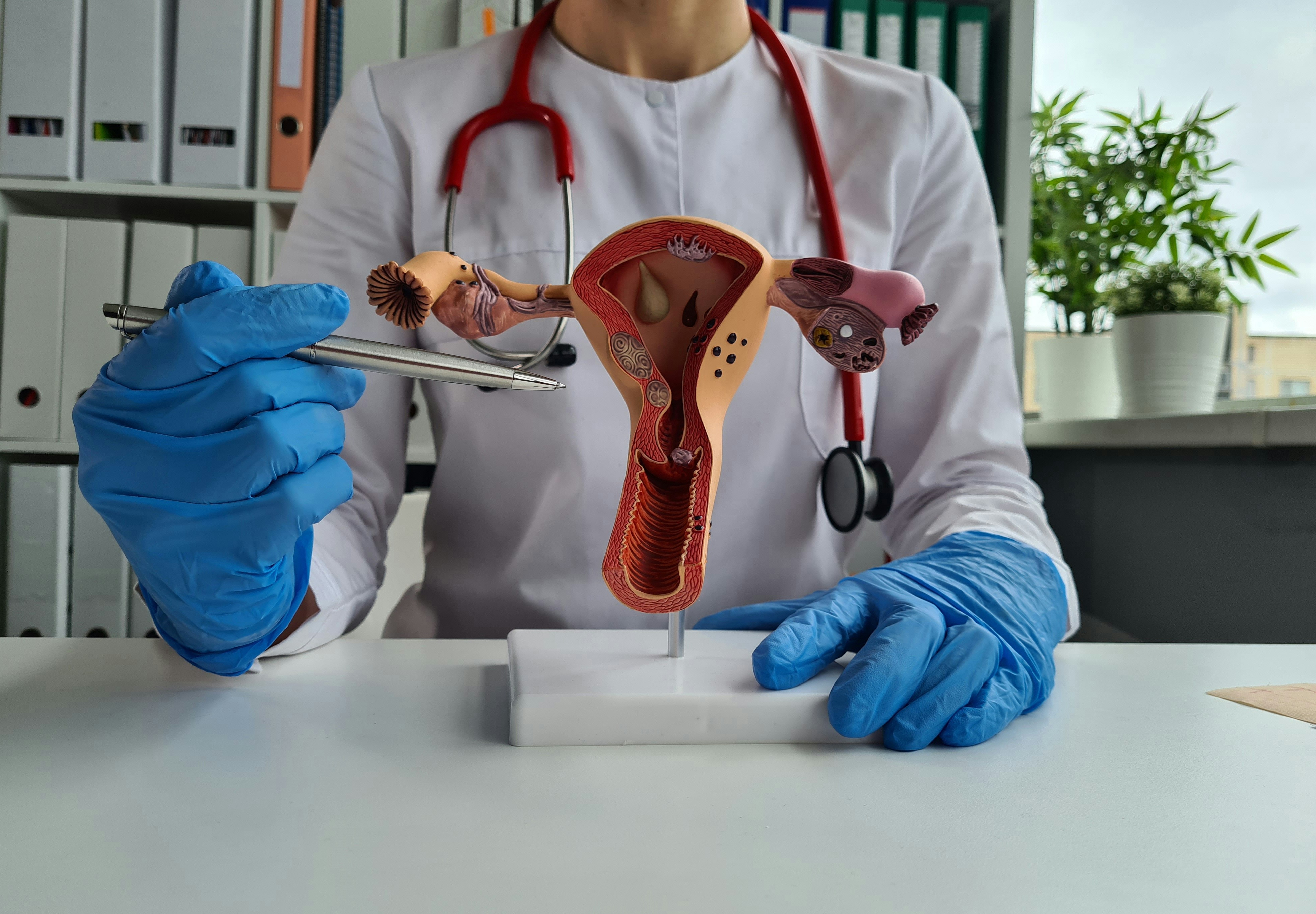 doctor discussing endometriosis biopsy using an anatomical uterus model
