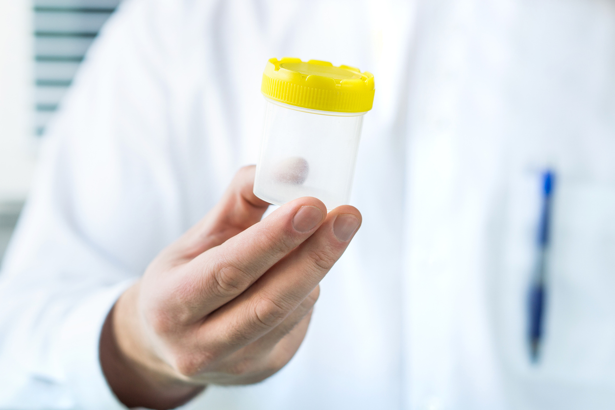 sperm collection jar