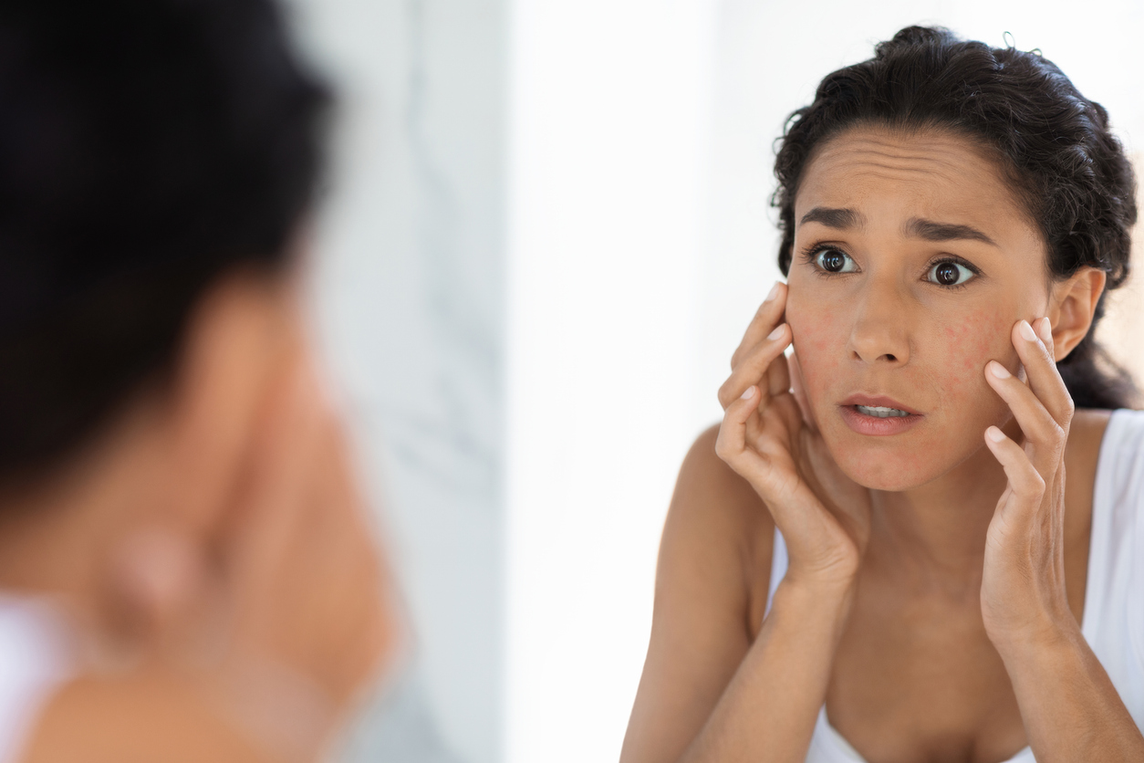 woman noticing perimenopause acne emerging on her jawline