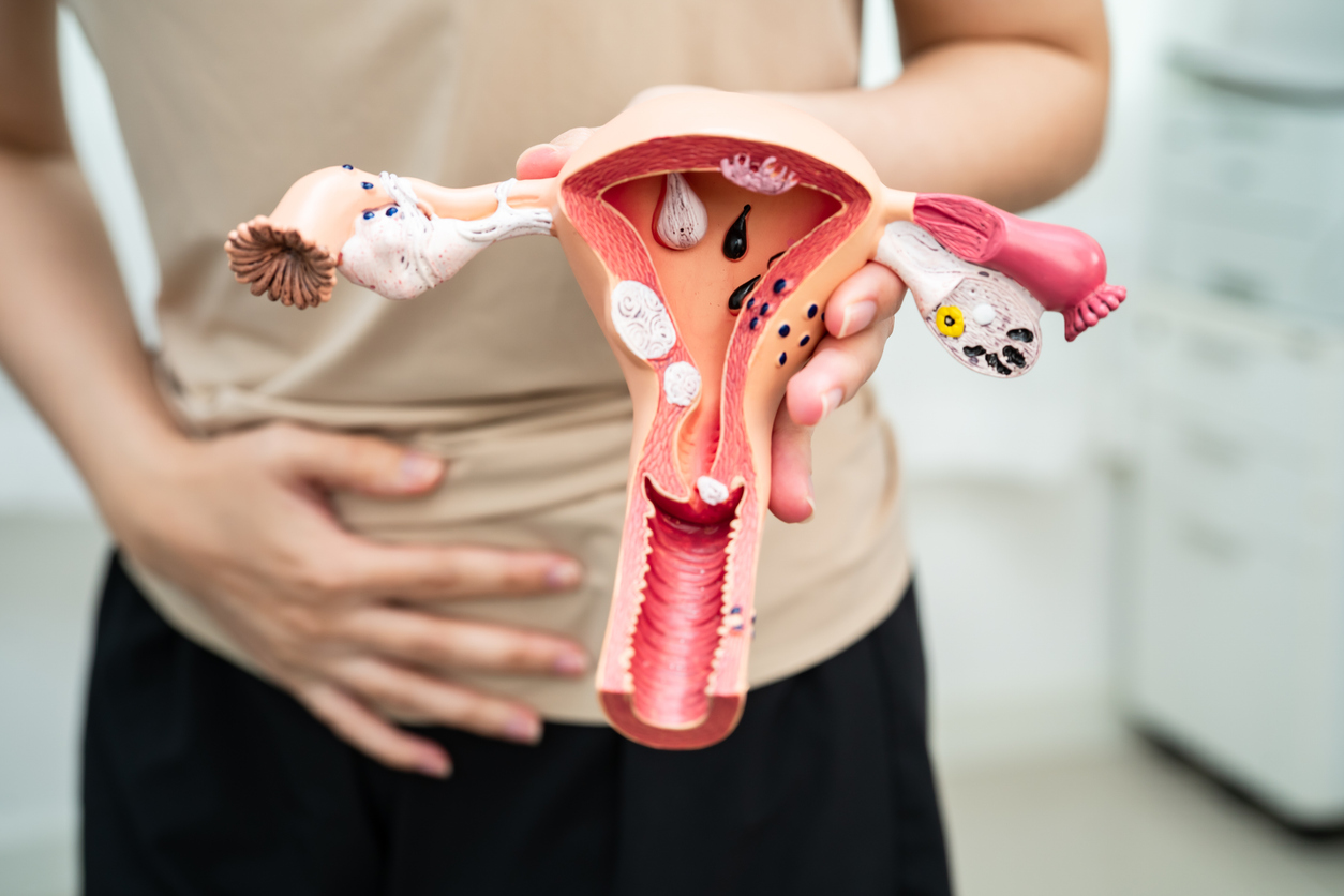 anatomical model of a uterus