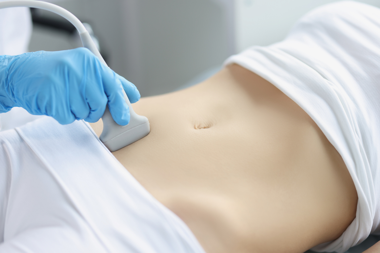 woman having an ultrasound