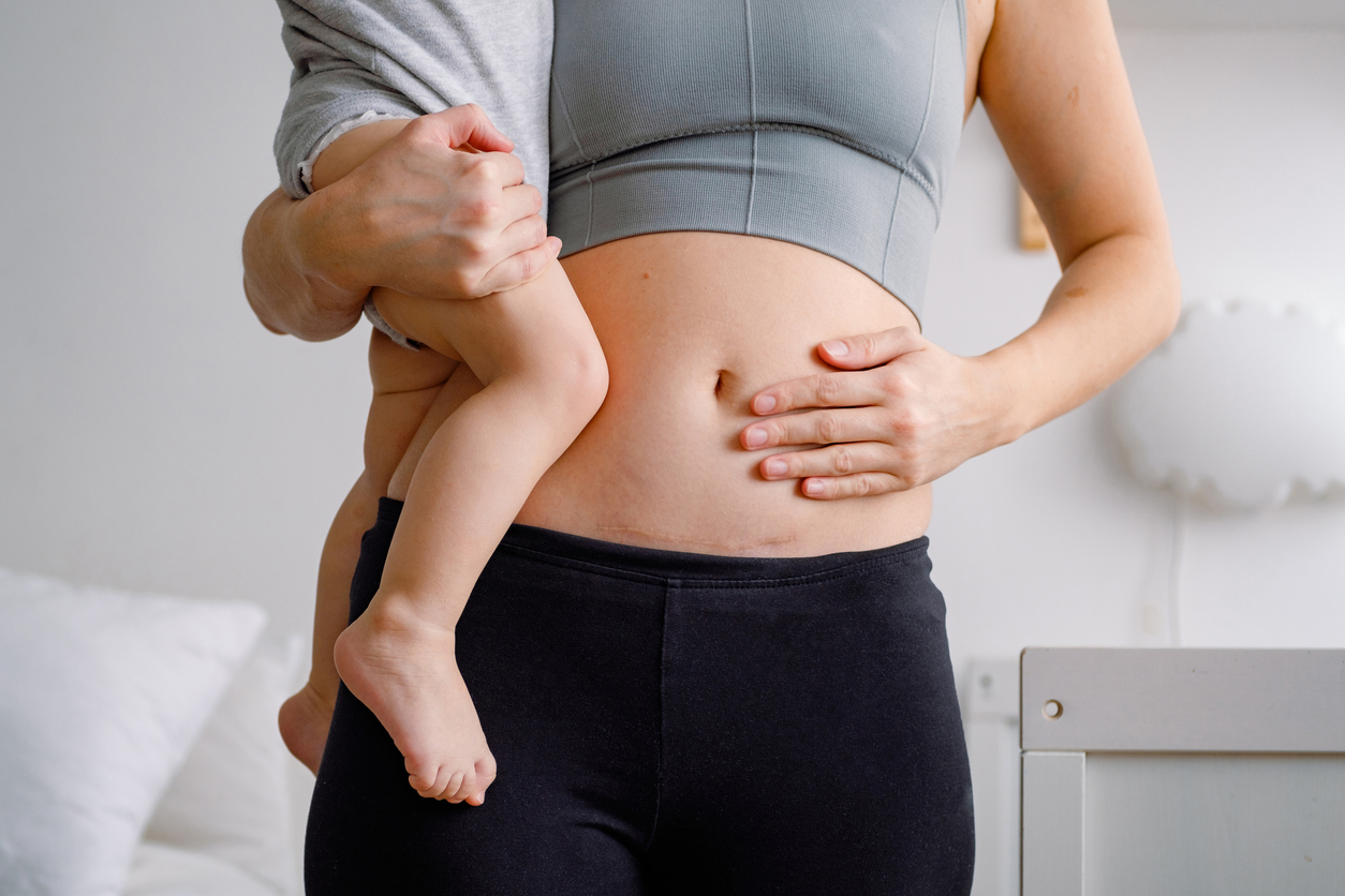 woman post c-section holding her baby and holding her mid-section