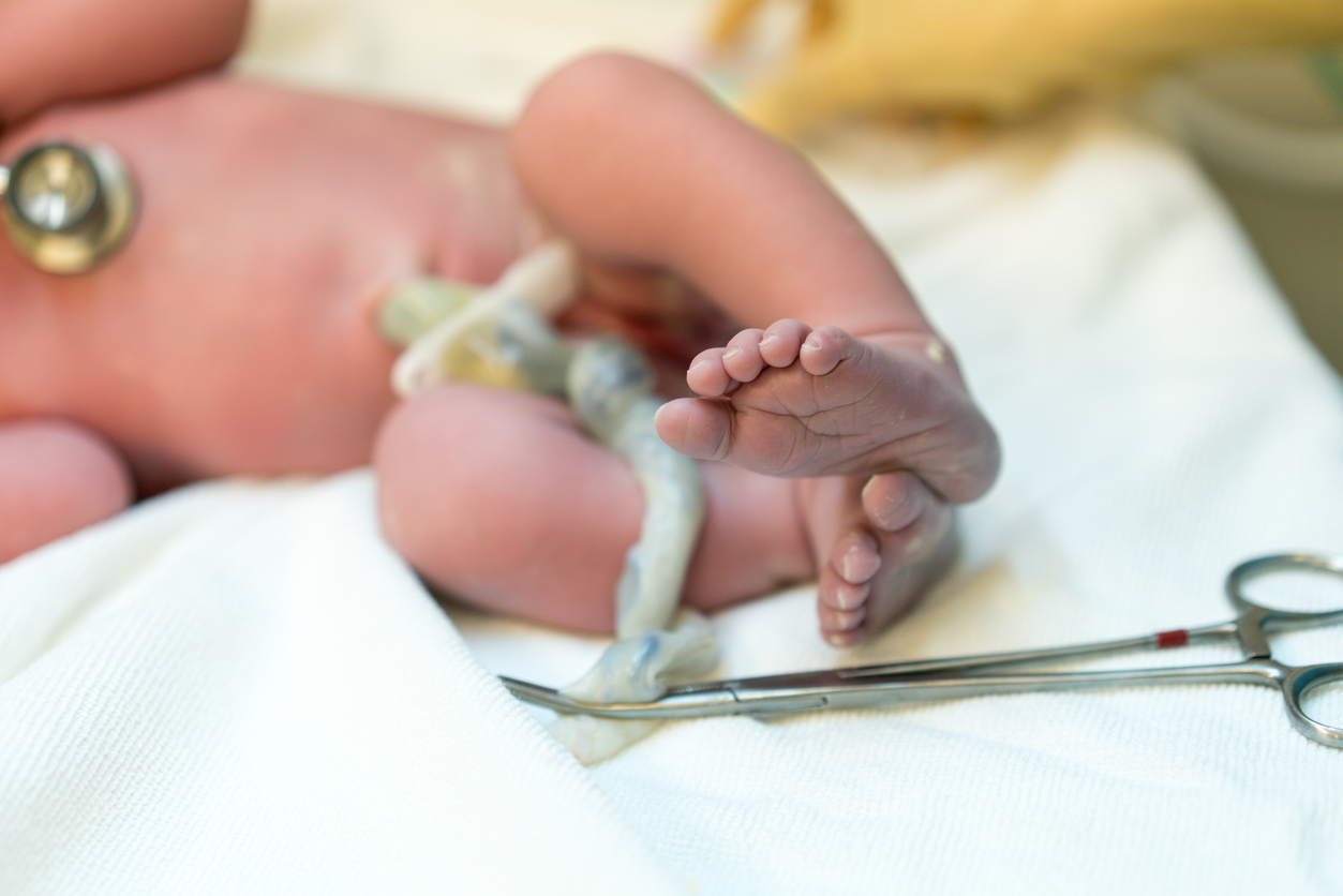 newborn baby with umbilical cord attached