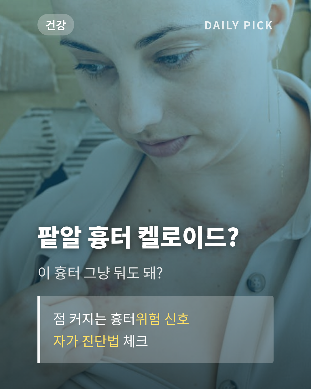 벌레 물린 후 켈로이드 자가진단 카드뉴스 1페이지 - 후크 및 핵심 질문