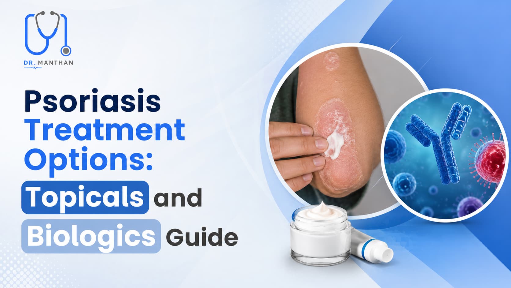 Psoriasis Treatment Options : Topical and Biologics