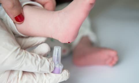 Test de Guthrie : détecter les potentielles maladies invisibles de bébé ?