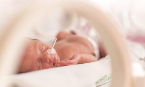 Hoe verzorg je een te vroeg geboren baby?