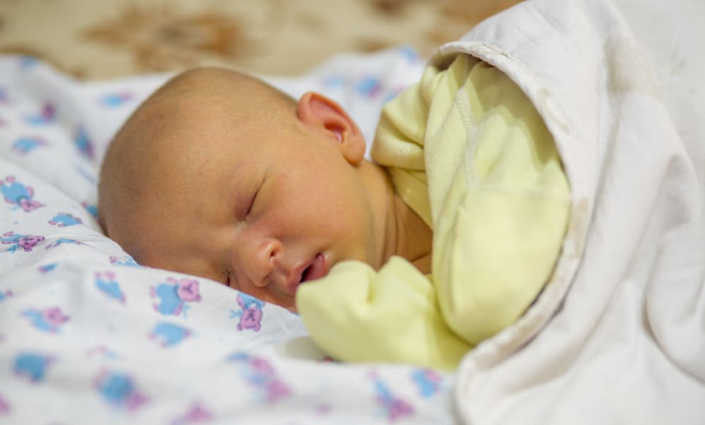 Jaunisse bébé : tout savoir sur le sujet