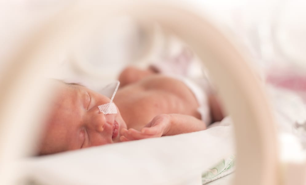 Hoe verzorg je een te vroeg geboren baby?
