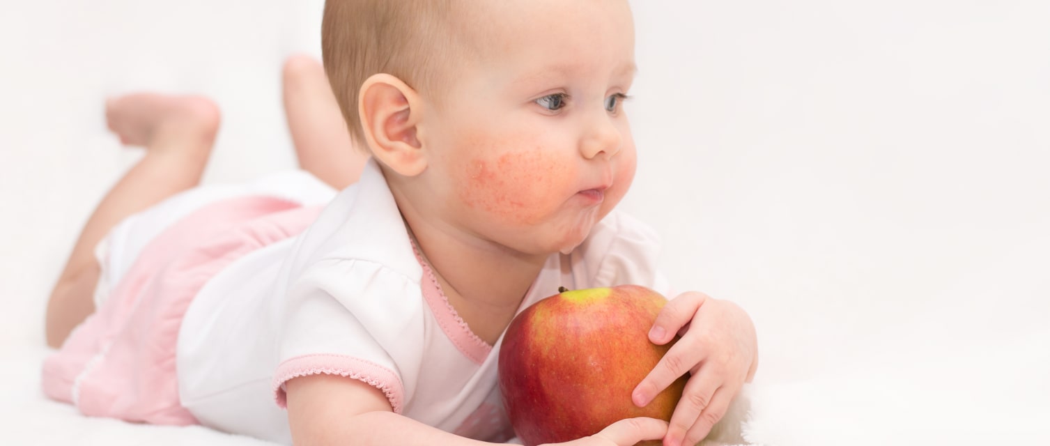Prevention Des Allergies Alimentaires Babyboom