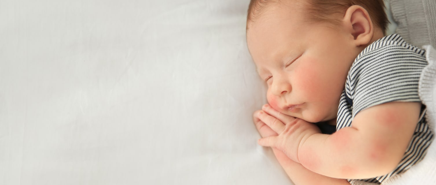 Sante De Bebe Les Allergies Babyboom