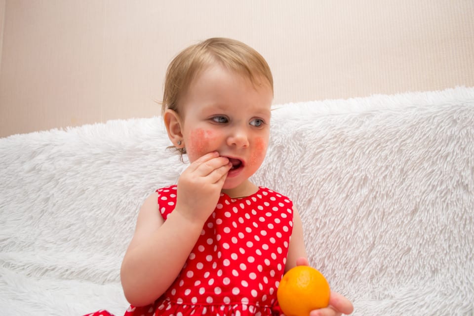 Les Allergies Alimentaires Babyboom