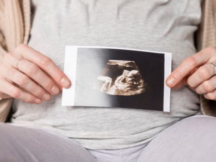 Минздрав предлагает показывать эмбрион женщинам, решившимся на аборт