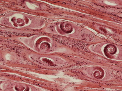 Трихинеллёз - не ставьте жизнь на карту!