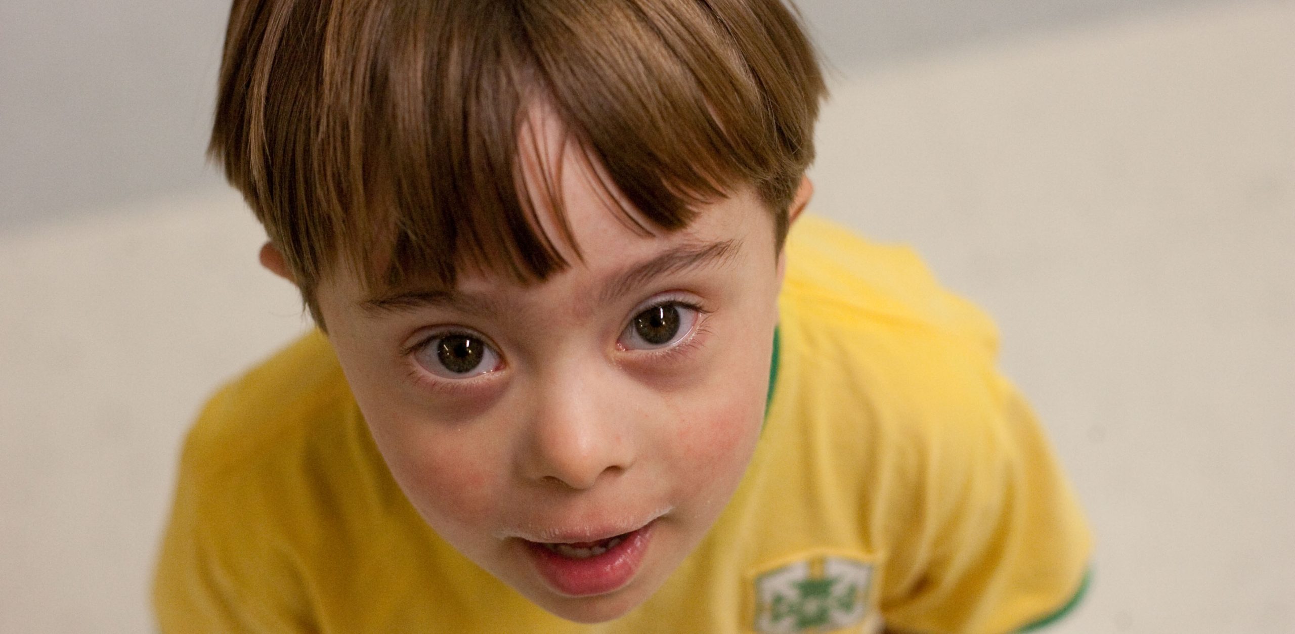 How is Down syndrome associated with an increased risk of infectious diseases?