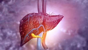 non-alcoholic fatty liver disease

