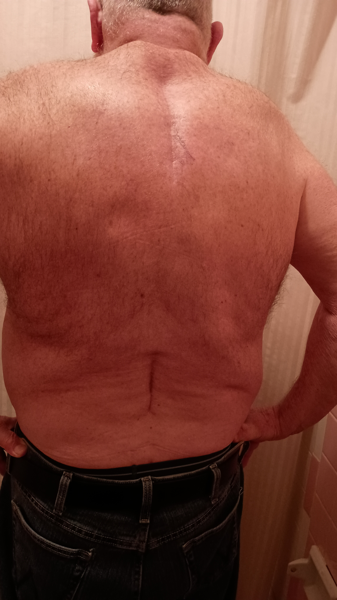 My back - 2026