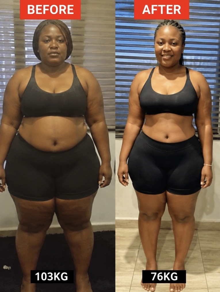 Ngozi