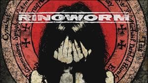 Ringworm