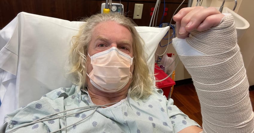 Dark Star Orchestra Rob Eaton Broken Arm