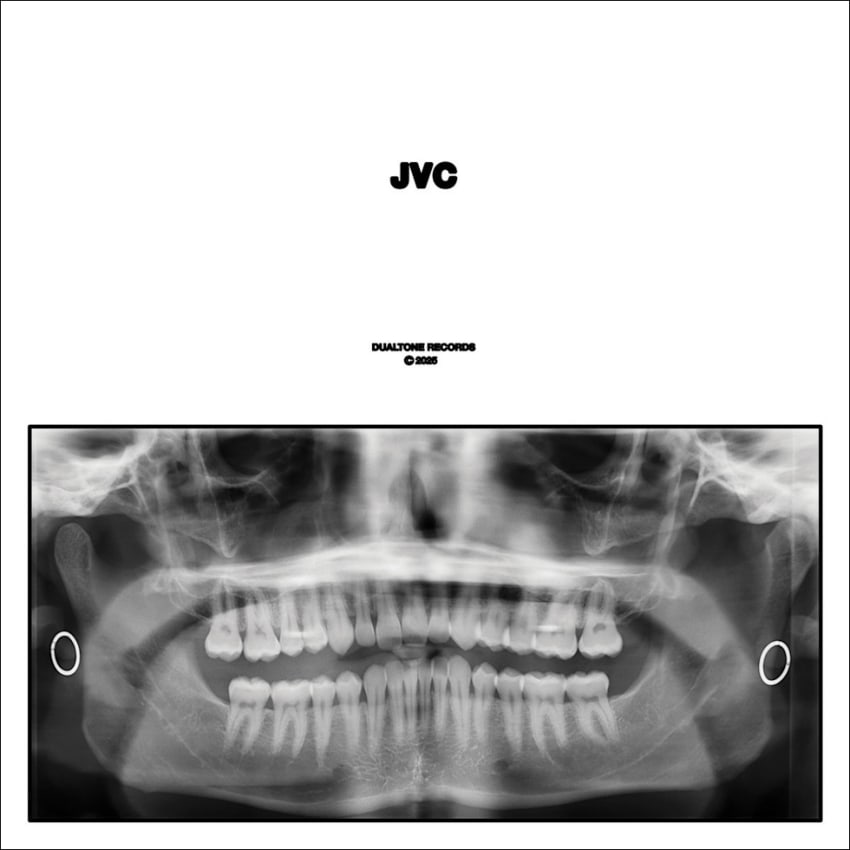 JVC border